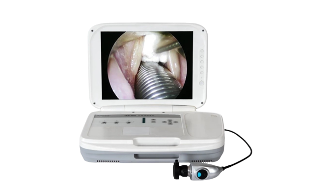Portable Endoscopy System